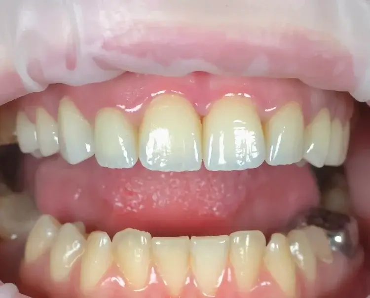 αισθητική οδοντιατρική