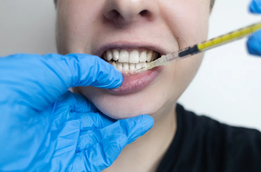 Θεραπεία Περιοδοντίτιδας